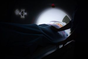 Should You Seek Medical Attention after You Sustain a Head Injury?