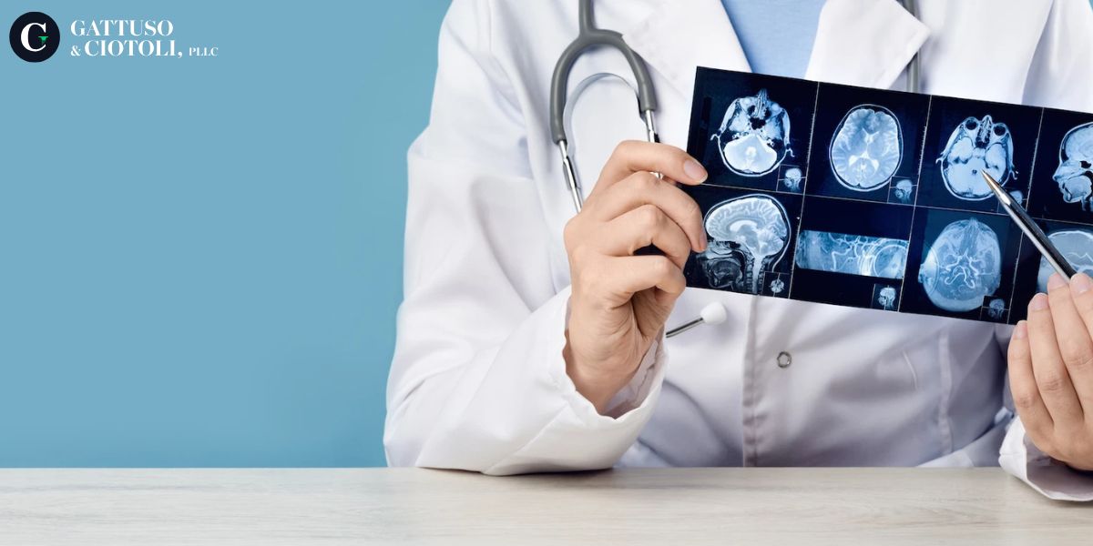 Rochester Traumatic Brain Injury Lawyer